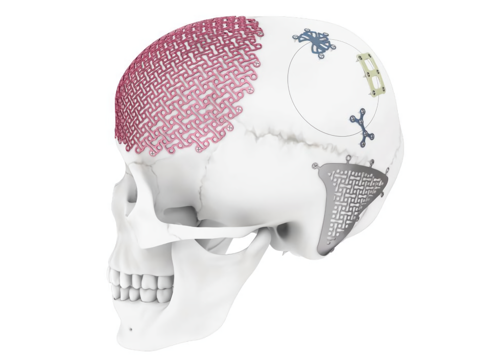 ¿Qué es CMF/Maxilofacial?